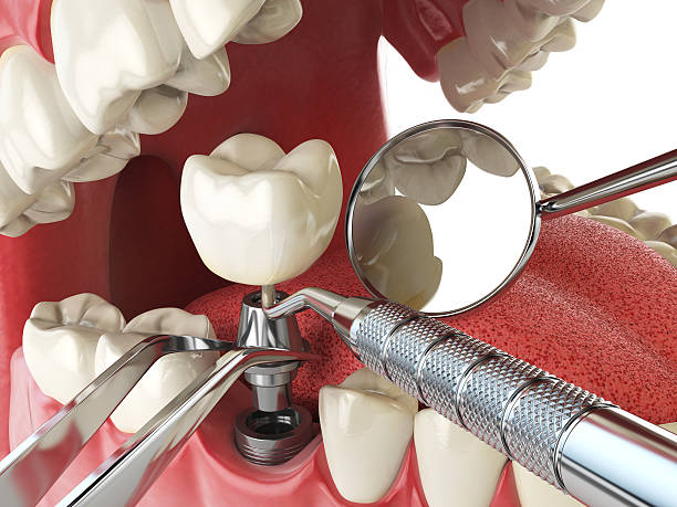 Best 24-Hour Emergency Dental Care in Alpharetta, GA